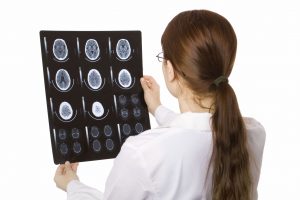 Female doctor examining a brain CT scan